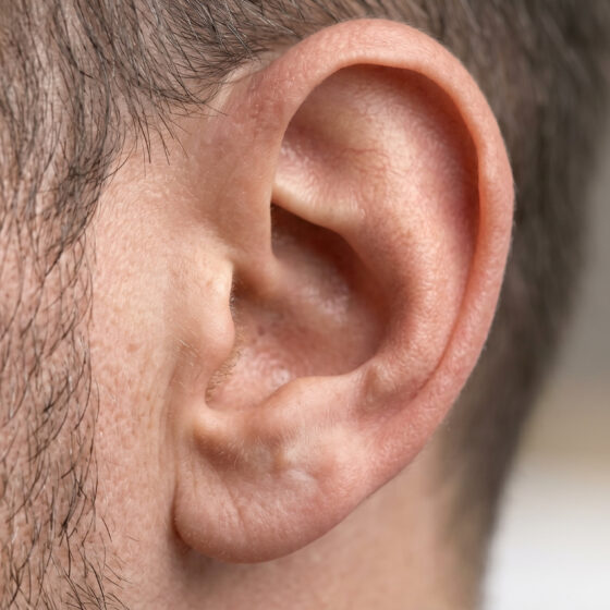 Labirintite: quando l’orecchio interno ti fa girare la testa