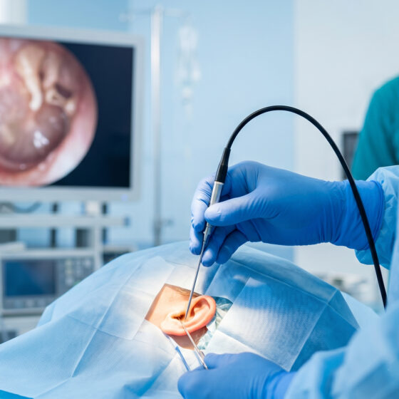 Intervento di otochirurgia endoscopica mini-invasiva
