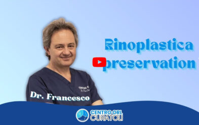 Rinoplastica Preservation: tecnica e vantaggi