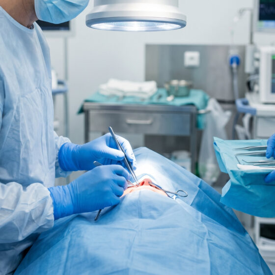 Tonsillectomia, intervento di rimozione delle tonsille al Centro ORL Curatoli a Bari